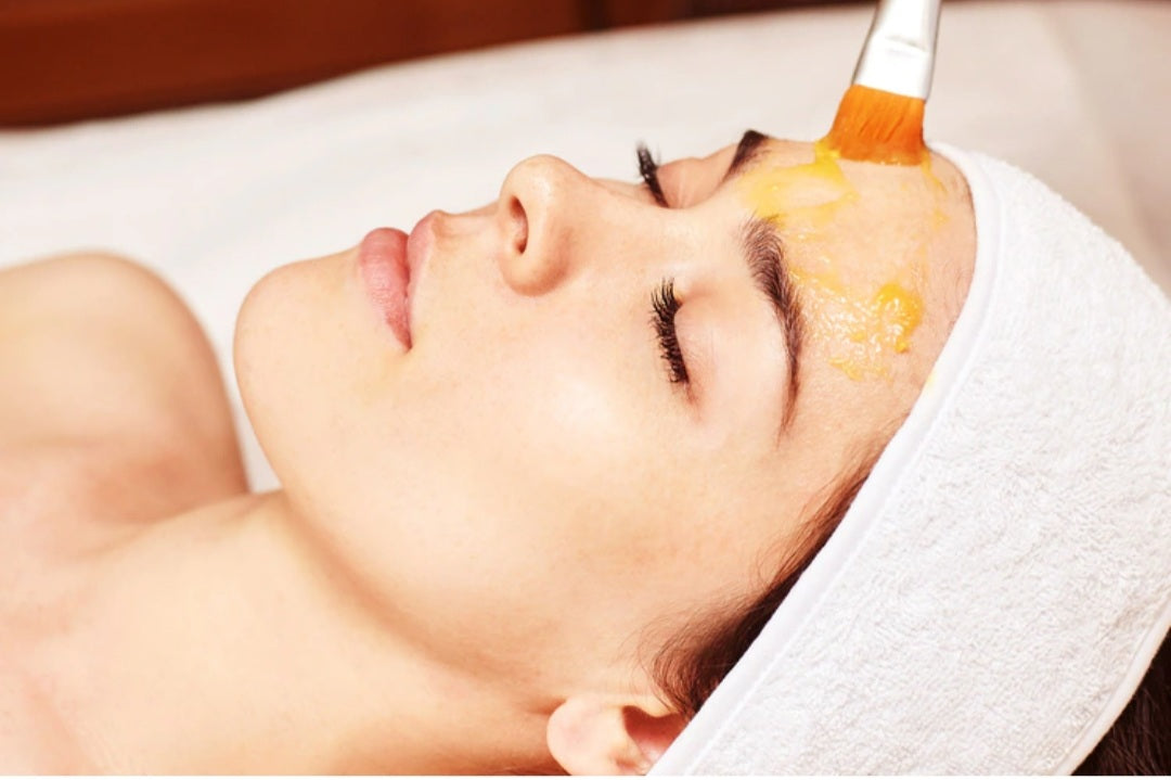 The Benifits of Chemical Peels